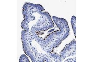 Immunohistochemical staining of human fallopian tube with CROCC polyclonal antibody  shows strong membranous positivity in ciliated cells. (CROCC 抗体)