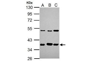 WB Image ARA9 antibody [N1C3] detects ARA9 protein by Western blot analysis.