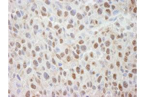 Immunohistochemistry (IHC) image for anti-Cullin 4A (CUL4A) (C-Term) antibody (ABIN7448505) (Cullin 4A 抗体  (C-Term))
