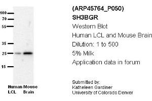 Image no. 2 for anti-SH3 Domain Binding Glutamic Acid-Rich Protein (SH3BGR) (N-Term) antibody (ABIN2782355) (SH3BGR 抗体  (N-Term))