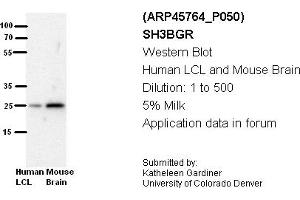 Image no. 2 for anti-SH3 Domain Binding Glutamic Acid-Rich Protein (SH3BGR) (N-Term) antibody (ABIN2782355)