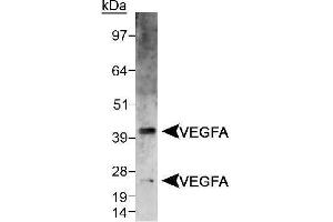 Image no. 2 for anti-Vascular Endothelial Growth Factor A (VEGFA) (AA 150-250), (Internal Region) antibody (ABIN363519) (VEGFA 抗体  (Internal Region))