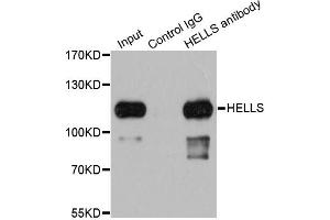 Immunoprecipitation analysis of 200ug extracts of 293T cells using 1ug HELLS antibody. (HELLS 抗体)