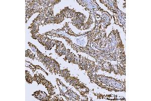 IHC analysis of Annexin A10/ANXA10 using anti-Annexin A10/ANXA10 antibody (ABIN7601853). (Annexin a10 抗体  (AA 49-324))