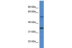 Image no. 1 for anti-Cytochrome B5 Reductase 4 (CYB5R4) (N-Term) antibody (ABIN6746476) (CYB5R4 抗体  (N-Term))