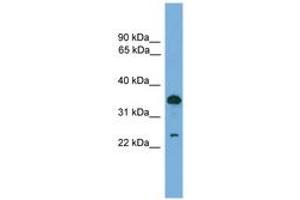 Image no. 1 for anti-Tumor Protein D52 (TPD52) (AA 81-130) antibody (ABIN6745546) (TPD52 抗体  (AA 81-130))