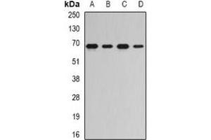 Western blot analysis of RNGTT expression in Jurkat (A), Hela (B), mouse spleen (C), rat kidney (D) whole cell lysates. (RNGTT 抗体)