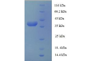 SDS-PAGE (SDS) image for Adaptor-Related Protein Complex 1, sigma 3 Subunit (AP1S3) (AA 1-104) protein (GST tag) (ABIN5709051)