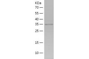 PBX1 Protein (AA 136-430) (His tag)