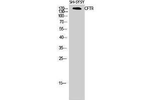Western Blotting (WB) image for anti-Cystic Fibrosis Transmembrane Conductance Regulator (ATP-Binding Cassette Sub-Family C, Member 7) (CFTR) (Ser246) antibody (ABIN3183888) (CFTR 抗体  (Ser246))