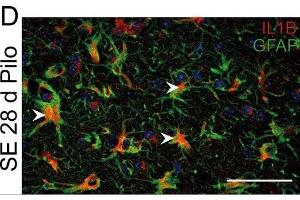Immunostaining of mouse hippocampal CA1 region showing GFAP and IL1B labeling of astrocytes 28 days after pilocarpine induced status epilepticus (SE). (GFAP 抗体  (AA 411-422))