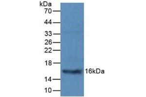 Detection of PCT in Mouse Pancreas Tissue using Polyclonal Antibody to Procalcitonin (PCT) (Procalcitonin 抗体  (AA 25-85))