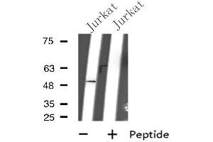 Western blot analysis of extracts from Jurkat cells, using GPR152 antibody. (GPR152 抗体  (N-Term))
