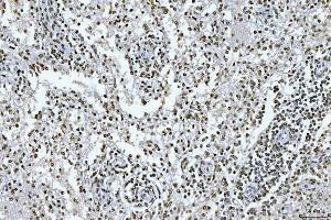 IHC analysis of GADD45B using anti-GADD45B antibody (ABIN7603219).
