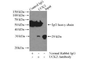 Immunoprecipitation analysis of Jurkat cells lysate 400 μg using UCK2 Antibody at a dilution of 1/1000. (UCK2 抗体)