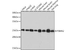 Western blot analysis of extracts of various cell lines, using PSM Rabbit mAb (ABIN7269597) at 1:1000 dilution. (PSMA2 抗体)