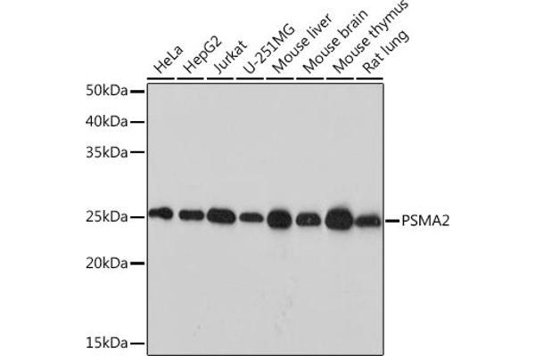 PSMA2 抗体