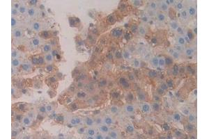 Detection of CBG in Rat Liver Tissue using Polyclonal Antibody to Corticosteroid Binding Globulin (CBG) (SERPINA6 抗体  (AA 267-390))