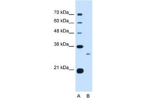 WB Suggested Anti-C1QB Antibody Titration:  0. (C1QB 抗体  (C-Term))
