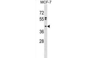 Western Blotting (WB) image for anti-Phosphatidic Acid Phosphatase Type 2 Domain Containing 2 (PPAPDC2) antibody (ABIN2999607) (PPAPDC2 抗体)