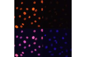 Immunofluorescence analysis of C6 cells using Acetyl-Histone H3-K4 antibody (ABIN7267672) at dilution of 1:100.