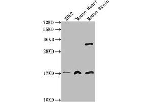 Western Blot Positive WB detected in: K562 whole cell lysate, Mouse heart tissue, Mouse brain tissue All lanes: FUNDC1 antibody at 3 μg/mL Secondary Goat polyclonal to rabbit IgG at 1/50000 dilution Predicted band size: 18 kDa Observed band size: 18 kDa (FUNDC1 抗体  (AA 1-46))