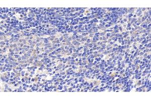 Detection of GRN in Rat Spleen Tissue using Polyclonal Antibody to Granulin (GRN) (Granulin 抗体  (AA 44-255))