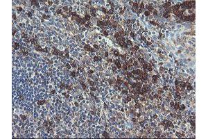 Image no. 12 for anti-Ubiquitin-Conjugating Enzyme E2, J1, U (UBE2J1) antibody (ABIN1501637)