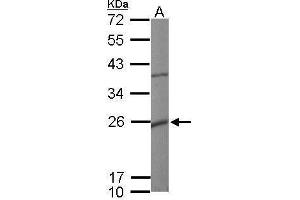 Western Blotting (WB) image for anti-Potassium Large Conductance Calcium-Activated Channel, Subfamily M, beta Member 1 (KCNMB1) (Center) antibody (ABIN2856153)
