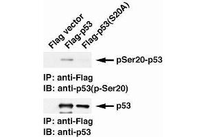 Western Blotting (WB) image for anti-Tumor Protein P53 (TP53) (pSer20) antibody (ABIN3201004) (p53 抗体  (pSer20))