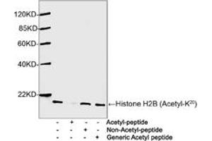 Western blot analysis of Hela cell lysates using 1 µg/mL Antibodies-Online Rabbit Anti-Histone H2B (Acetyl-K20) Polyclonal Antibody (ABIN398911) The signal was developed with IRDyeTM 800 Conjugated Goat Anti-Rabbit IgG. (Histone H2B 抗体  (Lys20))