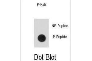 Dot Blot (DB) image for anti-Signal Transducer and Activator of Transcription 5A (STAT5A) (pSer726) antibody (ABIN5021402) (STAT5A 抗体  (pSer726))