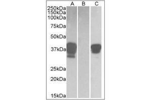 HEK293 lysate (10 µg protein in RIPA buffer) overexpressing Human POU2AF1 with DYKDDDDK tag probed with POU2AF1 Antibody  (1 µg/ml) in Lane A and probed with anti-DYKDDDDK Tag (1/3000) in Lane C. (POU2AF1 抗体  (C-Term))