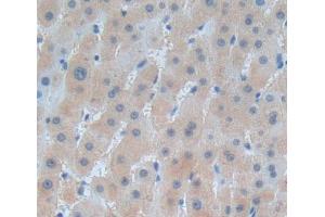 Used in DAB staining on fromalin fixed paraffin- embedded liver tissue (HARS1/Jo-1 抗体  (AA 1-294))