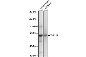 Western blot analysis of extracts of various cell lines, using ZNF124 antibody (ABIN7271452) at 1:1000 dilution. (ZNF124 抗体  (AA 60-200))