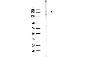 Western blot analysis of lysates from PC12 cells(UV,30 min treatment), using CCN Antibody at 1/1000 dilution.