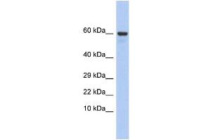 Western Blotting (WB) image for anti-Taxilin gamma (TXLNG) (N-Term) antibody (ABIN2785688) (Taxilin gamma (TXLNG) (N-Term) 抗体)
