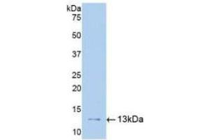 Detection of Recombinant uPAR, Human using Polyclonal Antibody to Plasminogen Activator, Urokinase Receptor (uPAR) (PLAUR 抗体  (AA 13-114))