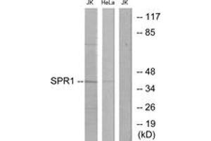 Western blot analysis of extracts from Jurkat/HeLa cells, using SPR1 Antibody. (SPR1 抗体  (AA 281-330))