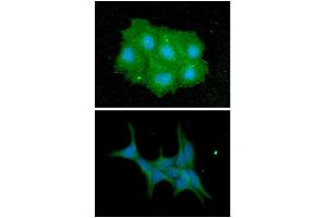 ICC/IF analysis of IMPA1 in Hep3B cells line, stained with DAPI (Blue) for nucleus staining and monoclonal anti-human IMPA1 antibody (1:100) with goat anti-mouse IgG-Alexa fluor 488 conjugate (Green).