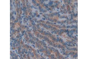 Used in DAB staining on fromalin fixed paraffin- embedded thyroid tissue (DPPA3 抗体  (AA 1-159))