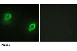 Immunofluorescence analysis of HeLa cells, using AKAP5 polyclonal antibody .