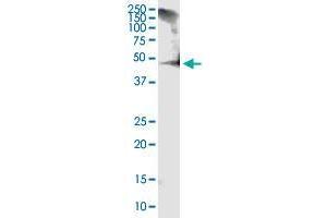 RCN1 monoclonal antibody (M01), clone 1F8-E4. (RCN1 抗体  (AA 31-331))