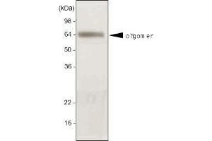 Western blot analysis. (ADIPOQ 抗体  (AA 15-244))