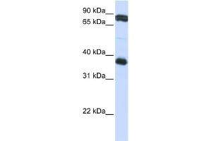 WB Suggested Anti-GP6 Antibody Titration:  0. (GP6 抗体  (Middle Region))