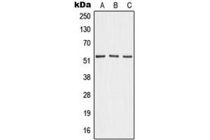 Western blot analysis of Angiopoietin-4 expression in HEK293T (A), mouse lung (B), PC12 (C) whole cell lysates. (Angiopoietin 4 抗体  (Center))