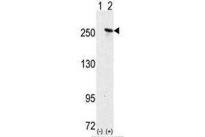 Image no. 1 for anti-Microtubule-Associated Protein 2 (MAP2) (C-Term) antibody (ABIN357399) (MAP2 抗体  (C-Term))