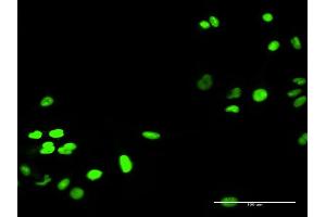 Immunofluorescence of purified MaxPab antibody to RECQL on HeLa cell. (RecQ Protein-Like (DNA Helicase Q1-Like) (RECQL) (AA 1-649) 抗体)