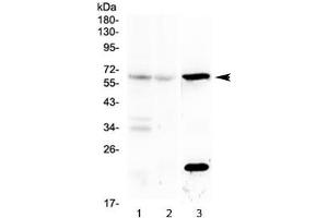 Western blot testing of mouse 1) brain, 2) liver and 3) kidney lysate with Il23r antibody at 0. (IL23R 抗体)