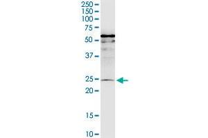 Western Blotting (WB) image for anti-MIS12, MIND Kinetochore Complex Component, Homolog (MIS12) (AA 1-205) antibody (ABIN528845)
